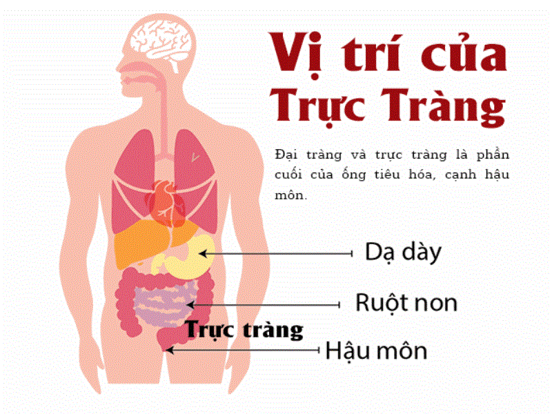 8 dấu hiệu cảnh báo sớm ung thư đại trực tràng